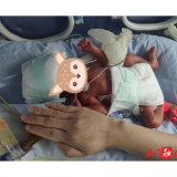 90天悉心守护“迷你宝宝”——石门县胎龄最小早产儿被成功救治