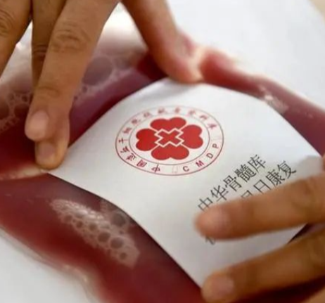 让大爱相“髓” 为生命接力