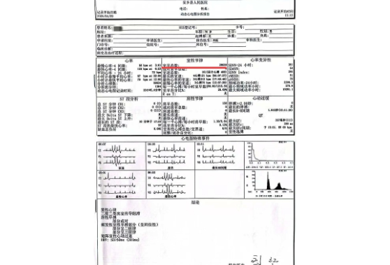 高龄患者重获“安心”  心脏介入实现突破 ——安乡县人民医院成功开展首例频发室性早搏射频消融术