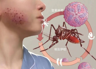 科学预防登革热——如何翻盆倒罐，清除蚊虫孳生地？