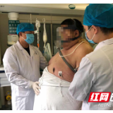 480斤“重量级患者”危在旦夕 湘雅二医院医护齐心协力化险为夷