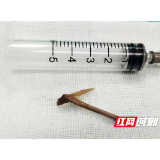 春节期间异物卡喉患者增多 专家：当心“祸从口入”