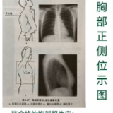 视频 | 胸部照片那点容易忽略细节，你get到了吗？