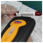 我为群众办实事 | 长沙市口腔医院:检验条码信息化 患者采血更方便