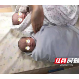 孕妈患上双胎输血综合征 胎儿镜术后平安诞下双胞胎