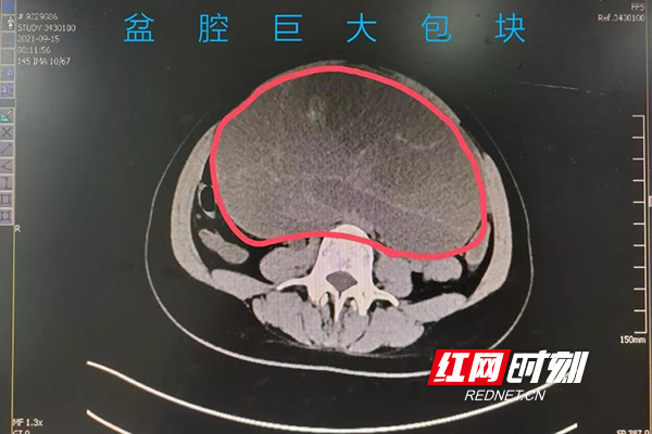 微信图片_20220126105439.jpg 微信图片_20220126105439.jpg