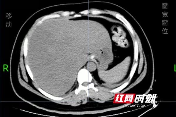 微信图片_20220208162516.jpg 微信图片_20220208162516.jpg