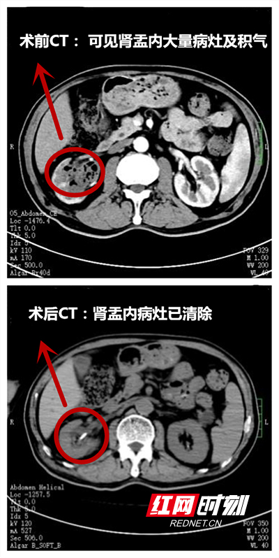 微信图片_20220315093347.jpg