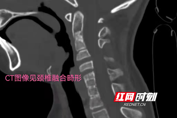 微信图片_20220329111148.jpg 微信图片_20220329111148.jpg