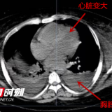 体重300斤也会营养不良？专家：胖却营养不良，后果更严重