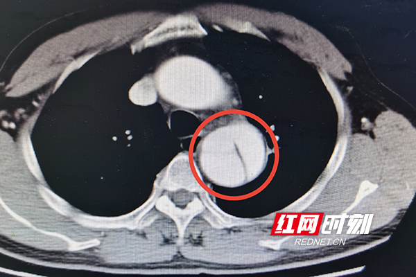 微信图片_20220609164133.jpg 微信图片_20220609164133.jpg