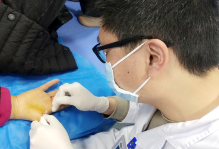 小身材大作为 长沙市中医医院小针刀治疗腱鞘炎