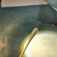 武汉两岁男童眼睛里活捉6条寄生虫 医生：家有宠物的请当心！