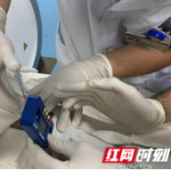 小细针大能耐 娄底市第二人民医院肺结节诊断迈上新台阶