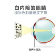 老花眼可以不戴眼镜？听听专家怎么说