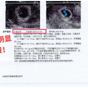 都是假冒的！手把手教你识破这几种“试管”圈套，远离地下黑机构！