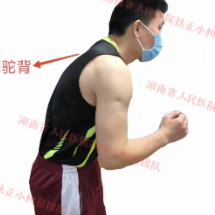 你跑步时有哪些不良体态？本周六湖南省人民医院可免费评估