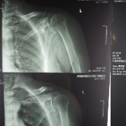 这种“钓鱼病”总是缠绕钓鱼人 看看你中招了吗