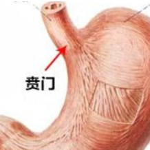 聚餐后催吐出现呕血？当心贲门撕裂在“作祟”