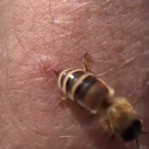 注意!秋季蜂蜇伤高发,长沙有医院日均接诊5例