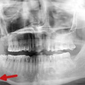 男子一吃饭就疼得张不开嘴！医生：千万不要忍