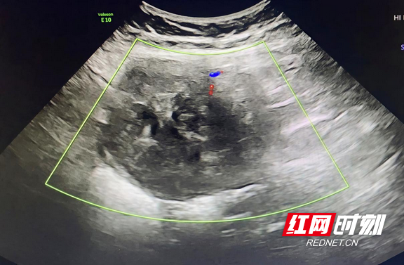 图片1.wm.png 图片1.wm.png