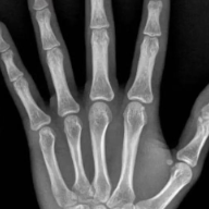 湖南中医附一即将开启“六一”国际儿童节助长义诊