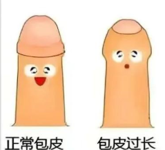 包皮手术暑期迎高峰 医生提醒：这些情况才需“动刀”