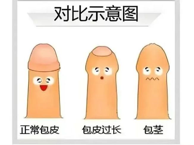 示意图.jpg