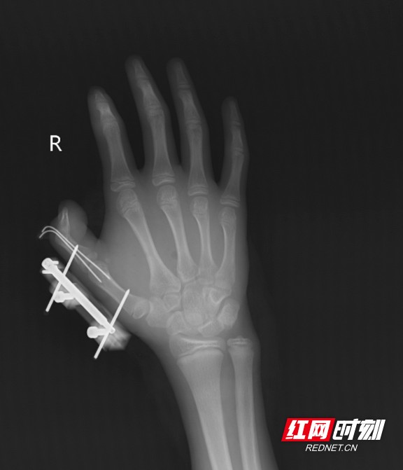 微信图片_2025-08-14_102534_269.wm.jpg