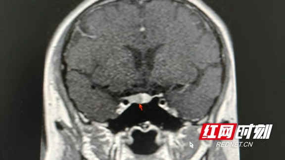 微信图片_20250917150759_298_269.wm.jpg 微信图片_20250917150759_298_269.wm.jpg