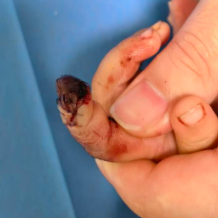 “兔子急了也咬人”！男童被宠物兔咬伤，手指险坏死