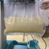 双胎孕妇血液变成“牛奶”，甘油三酯是正常值60多倍！湖南省妇幼多学科联手救下母婴三人