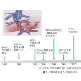 打通肝硬化患者“任督二脉”，湖南省第三人民医院TIPS手术再次立功