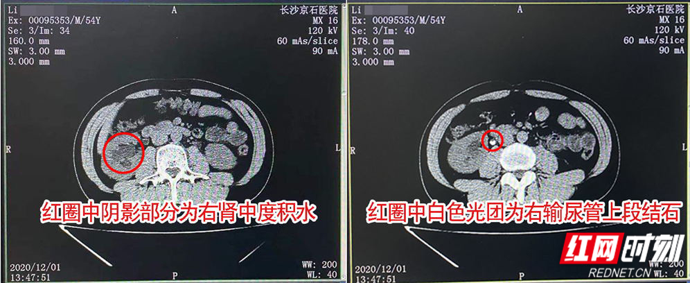 160940330114(1)_看图王.jpg 160940330114(1)_看图王.jpg