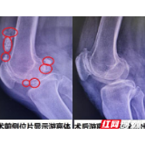 微创“打洞“巧捉“关节鼠”