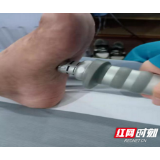 仅两次便缓解疼痛 冲击波也可以是治愈系