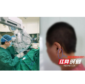 岳阳市中心医院神经外科完成首例粗大椎动脉压迫面神经悬吊术