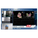 岳阳市一人民医院精准房颤消融术跨省直播