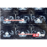 娭毑信偏方治疗胆囊结石数月 腹痛就医才知结石掉入胆总管