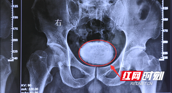 微信图片_20220325145749.wm.png