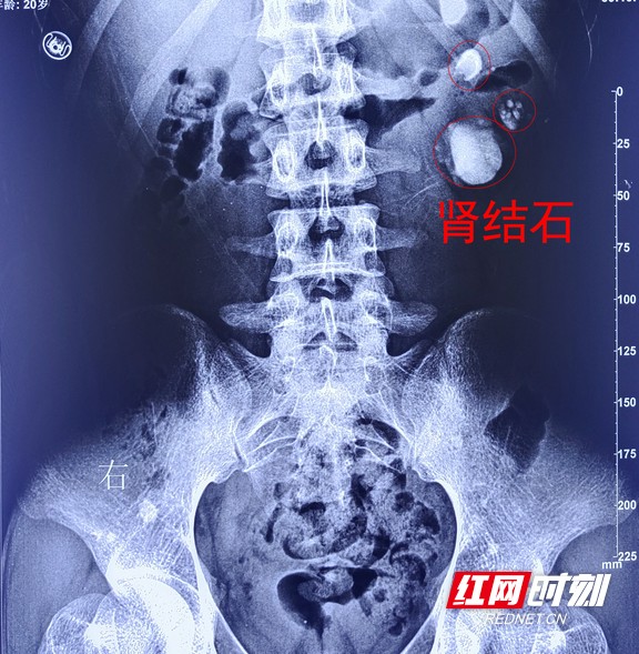 图片7.wm.jpg