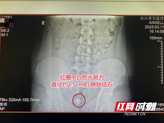图片12.wm.jpg