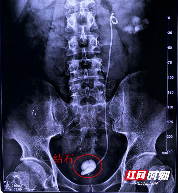 图片16.wm.jpg