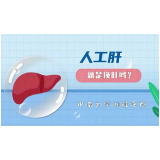 中南大学湘雅医院：“人工肝”就是“换肝”吗？
