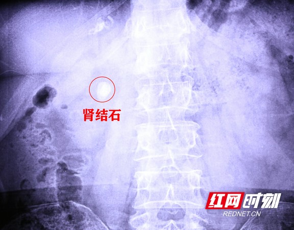 图片8.wm.jpg