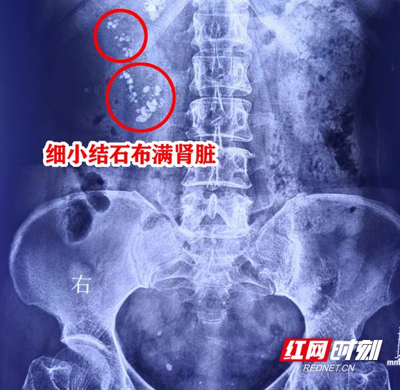 图片18.wm.jpg