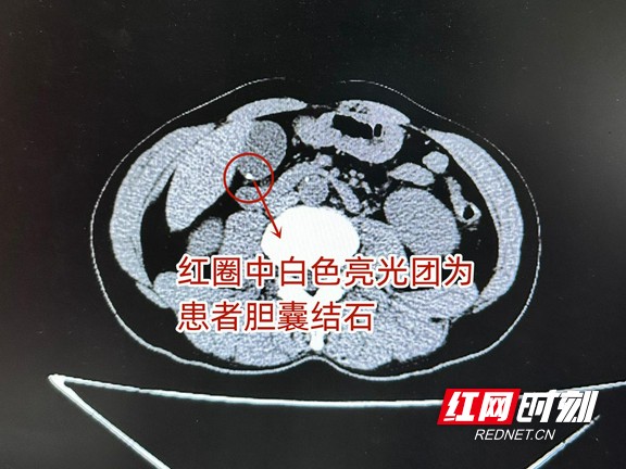图片10.wm.jpg