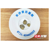 女子患结石拖延12年未治 如今保胆取出3大颗“鹅卵石”