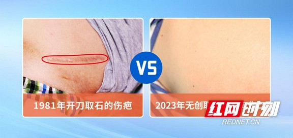 图片4.wm.jpg